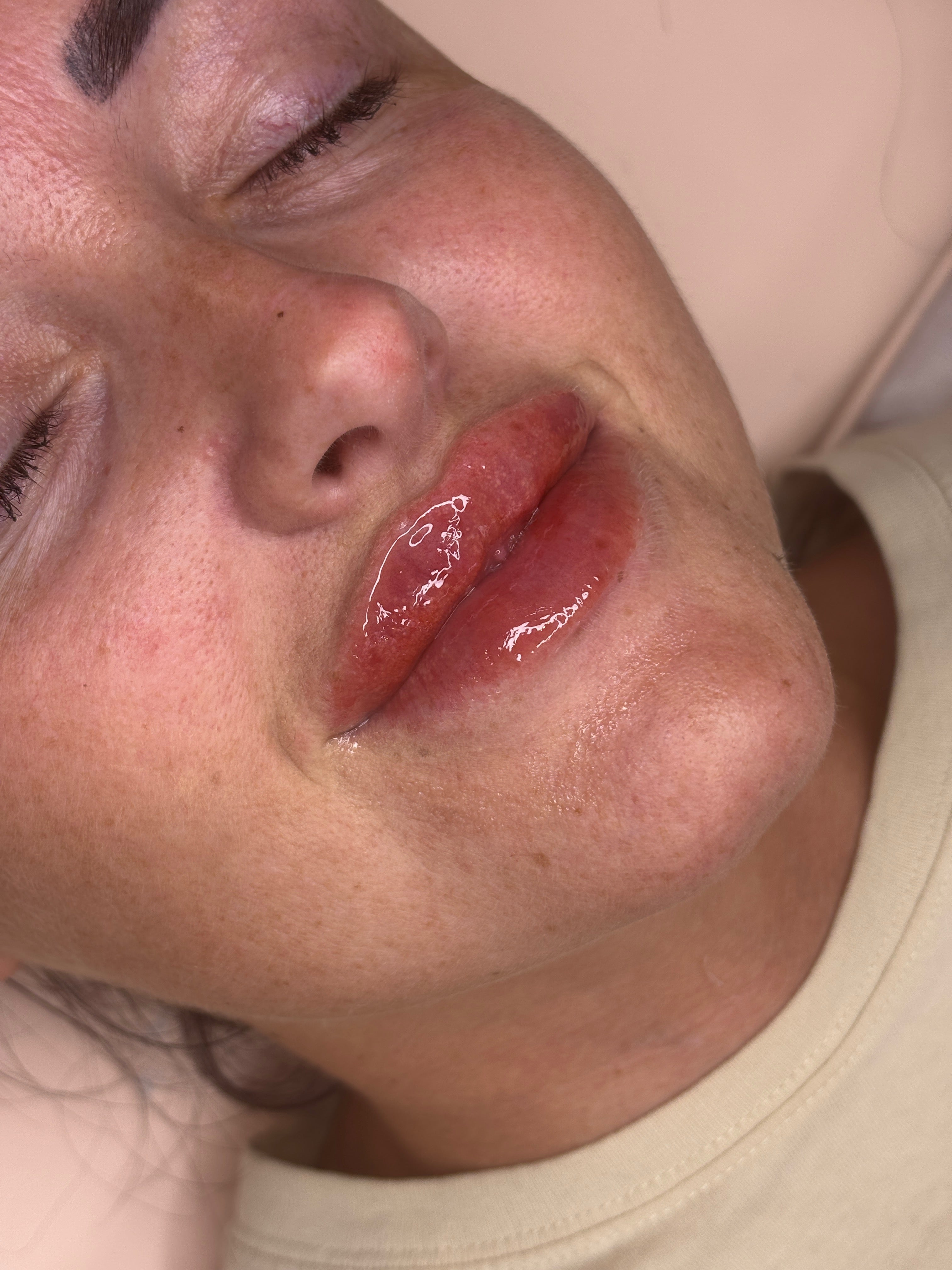 3D flat lips