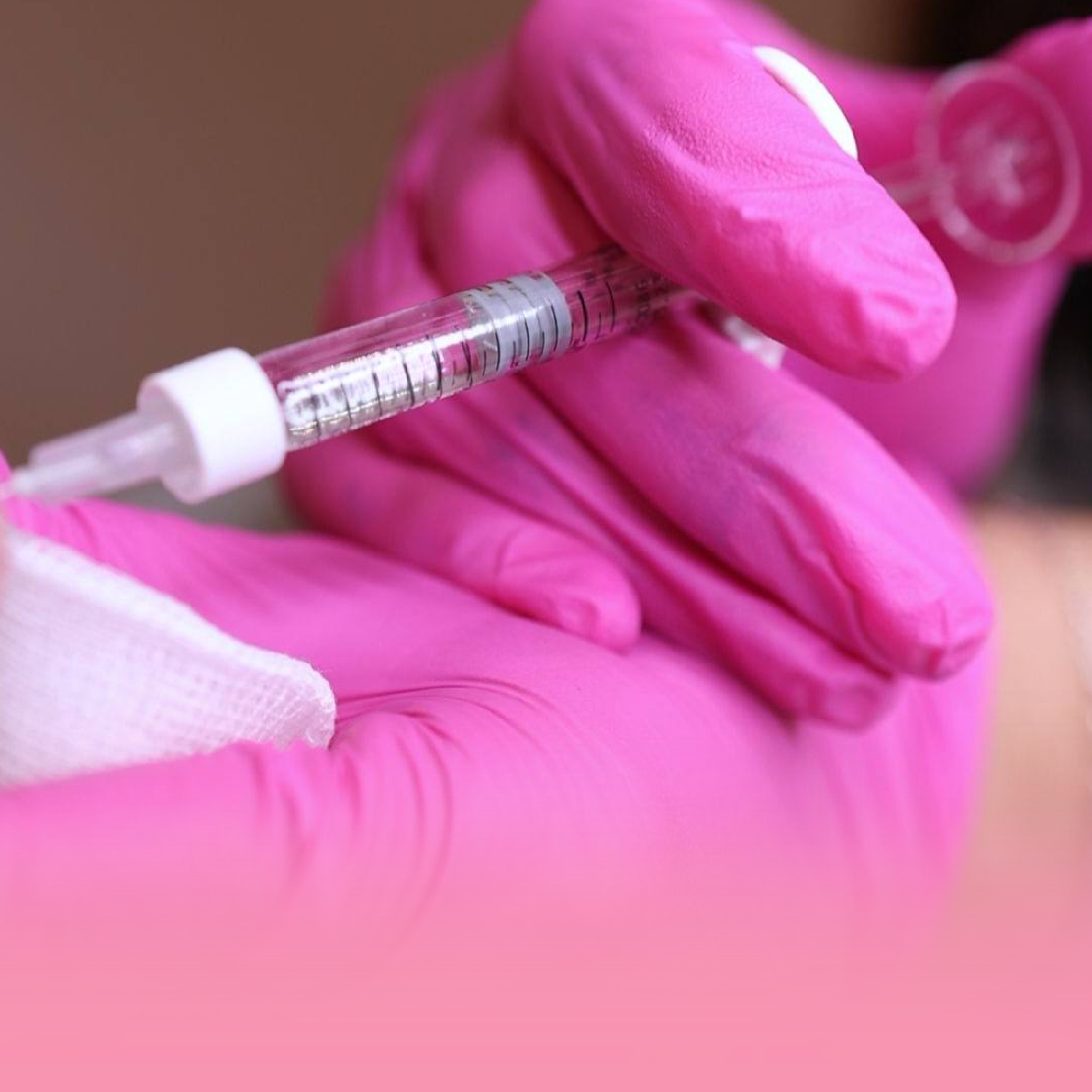 Non surgical rhinoplasty